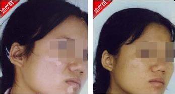 女性白癜风应该怎样护理?(图1)