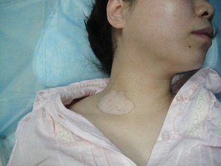 怎么护理白癜风好得快?(图1)