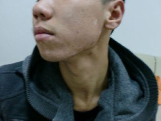 白癜风的发病对患者的影响有多少(图1)
